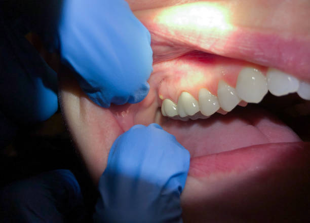 Best Emergency Dental Surgery in Roeland Park, KS